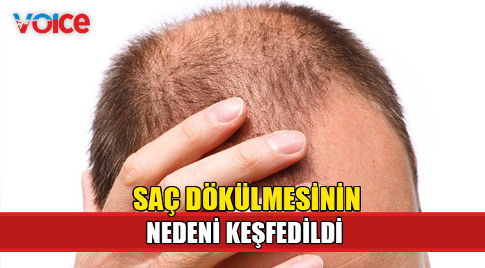 Kronik stresin saç dökülmesine yol açmasının nedeni keşfedildi