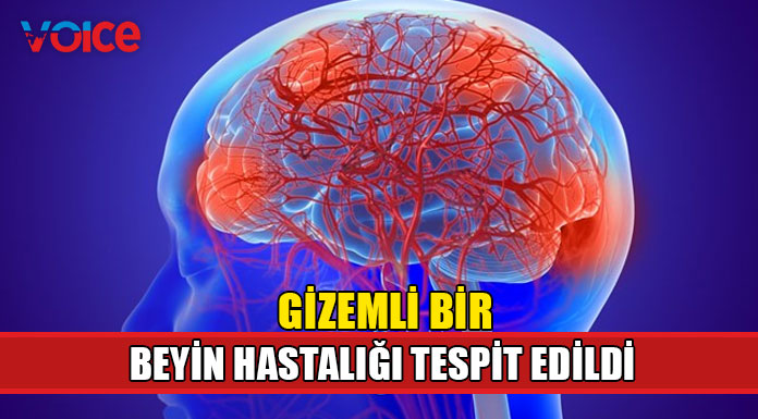 Kanada'da gizemli beyin hastalığı!