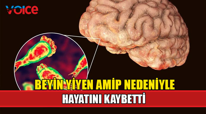 ABD'de bir çocuk beyin yiyen amip nedeniyle hayatını kaybetti