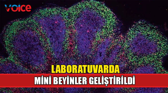 Cambridge Üniversitesi'nden demans ve felce karşı önemli adım