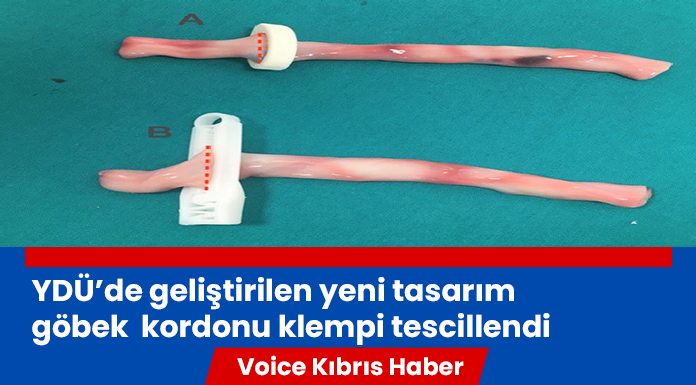 YDÜ aştırmacılarının geliştirdiği yeni tasarım göbek kordonu klempi (Kord Klemp)tescillendi
