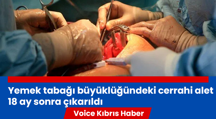 Ameliyatta karında unutulan cerrahi alet 18 ay sonra çıkarıldı